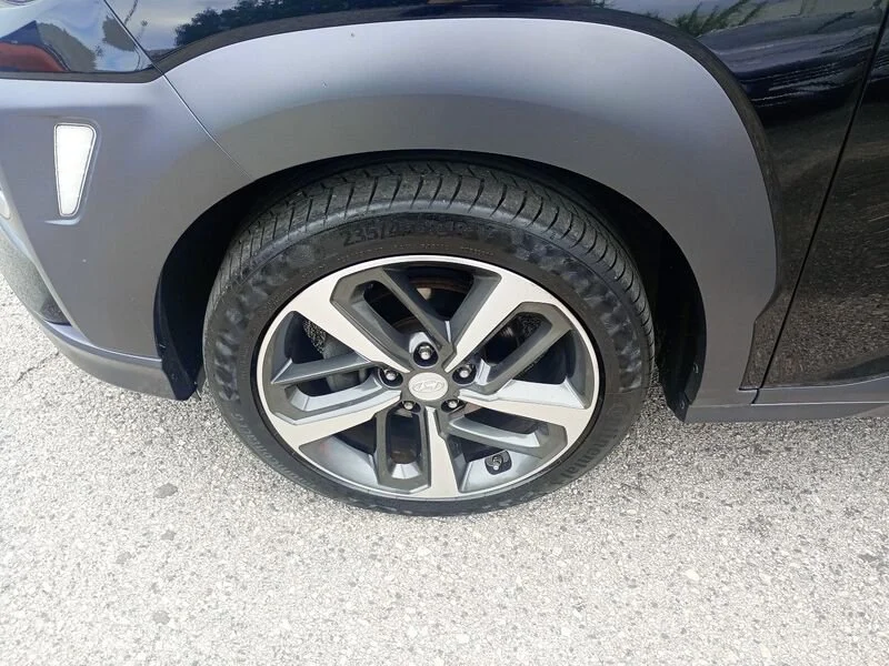 Hyundai Kona Kona 1.6 crdi Xpossible 2wd 115cv- Gruppo Diba